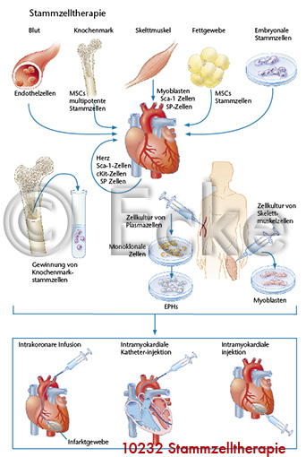 Stammzelltherapie 6