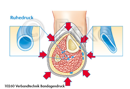 Ruhedruck