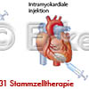 Stammzelltherapie 5