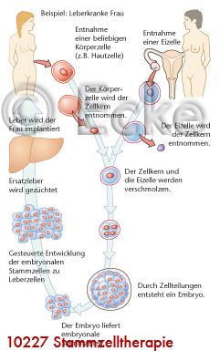 Stammzelltherapie 1