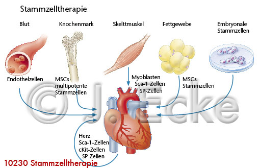 Stammzelltherapie 2