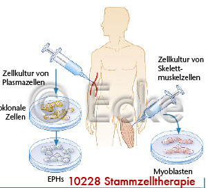 Stammzelltherapie 7